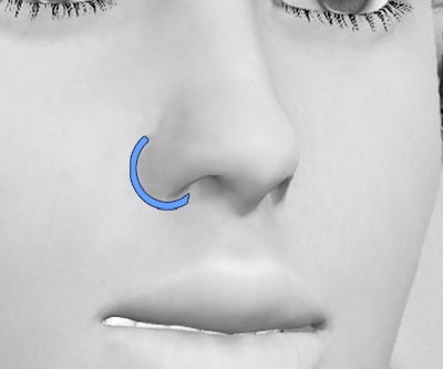 scars custom rhinoplasty - III